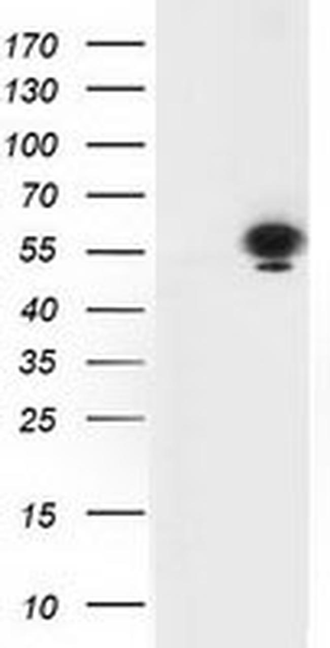 p53 Antibody in Western Blot (WB)