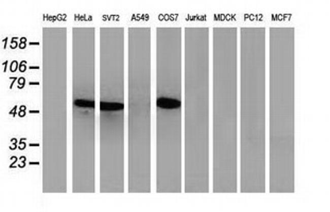 p53 Antibody in Western Blot (WB)