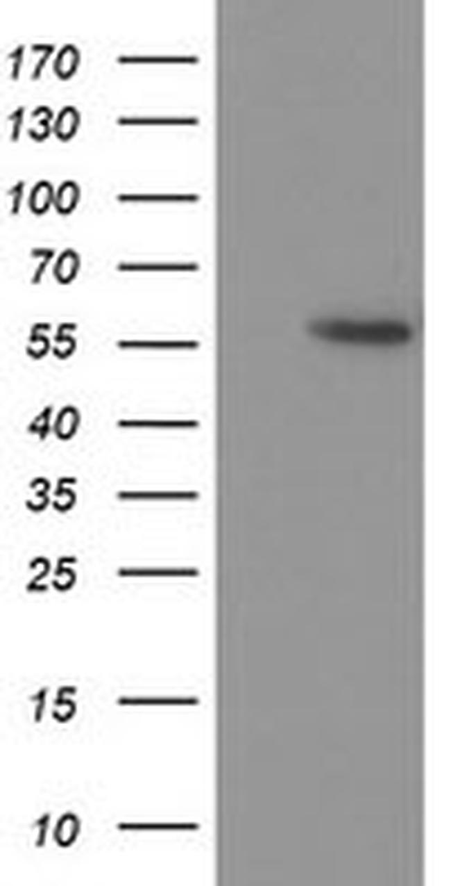 p53 Antibody in Western Blot (WB)