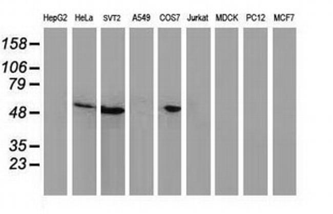 p53 Antibody in Western Blot (WB)