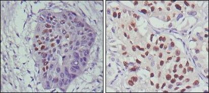 p53 Antibody in Immunohistochemistry (Paraffin) (IHC (P))