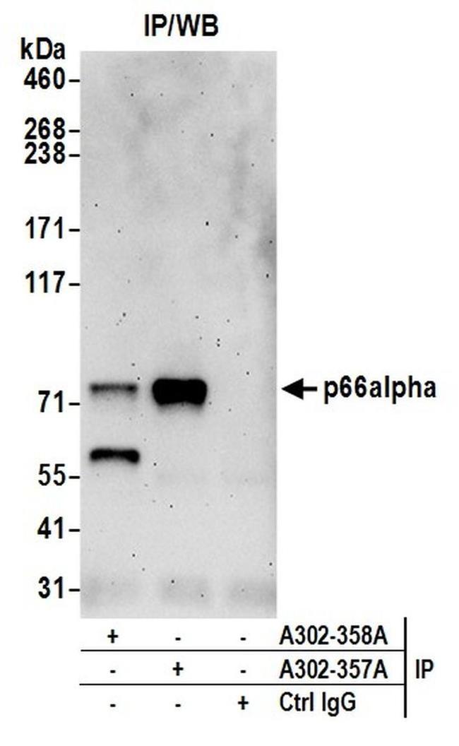 p66alpha Antibody in Western Blot (WB)