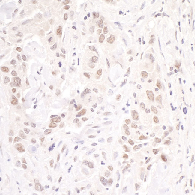 p66beta/GATAD2B Antibody in Immunohistochemistry (IHC)