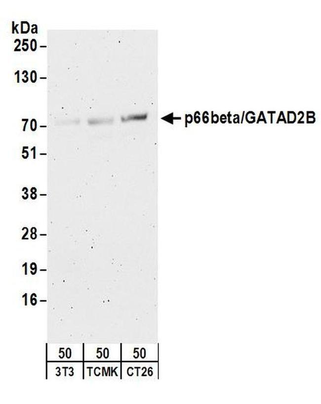 p66beta/GATAD2B Antibody in Western Blot (WB)