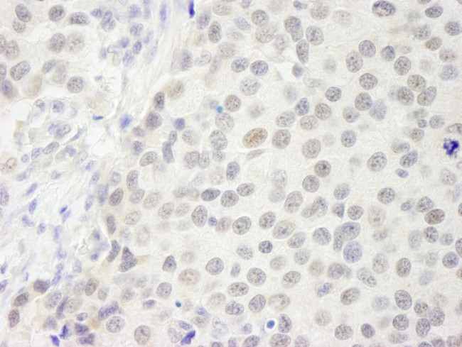 p66beta/GATAD2B Antibody in Immunohistochemistry (IHC)