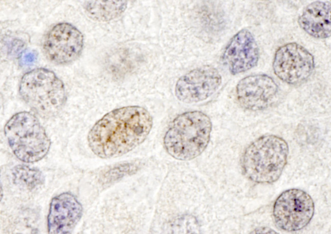 p66beta/GATAD2B Antibody in Immunohistochemistry (IHC)