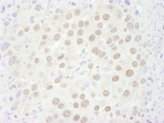 p66beta/GATAD2B Antibody in Immunohistochemistry (IHC)