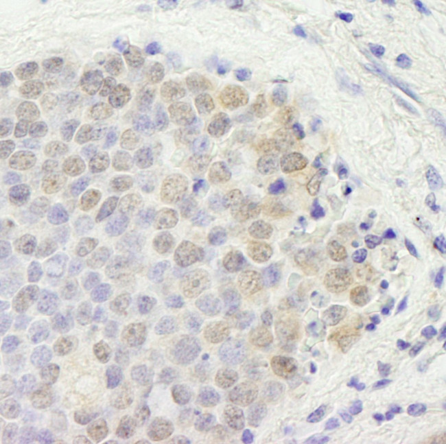 p66beta/GATAD2B Antibody in Immunohistochemistry (IHC)