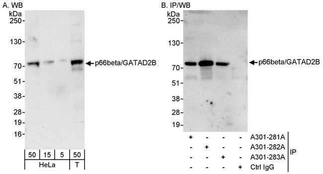 p66beta/GATAD2B Antibody in Western Blot (WB)