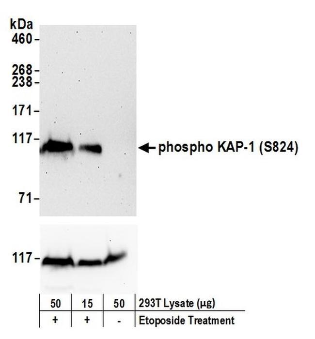 Phospho-KAP-1 (Ser824) Antibody in Western Blot (WB)