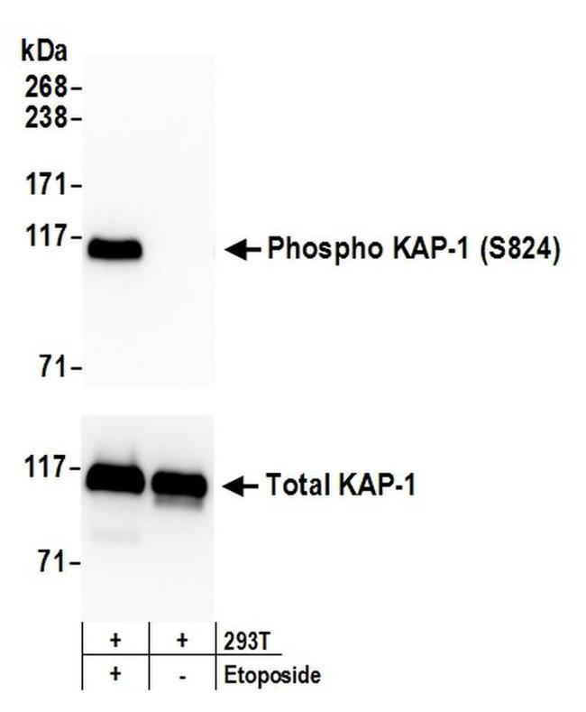 Phospho-KAP-1 (Ser824) Antibody in Western Blot (WB)