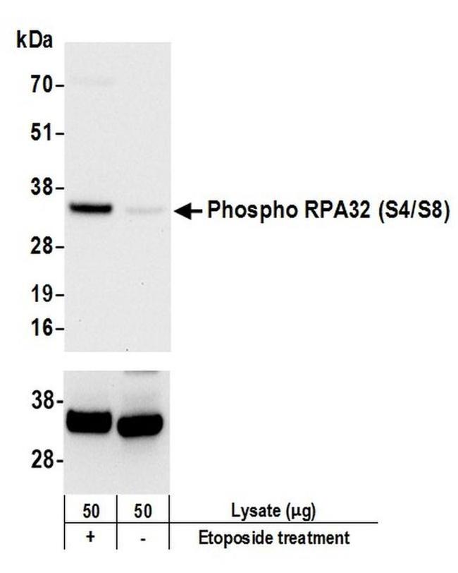 Phospho-RPA32 (Ser4, Ser8) Antibody in Western Blot (WB)