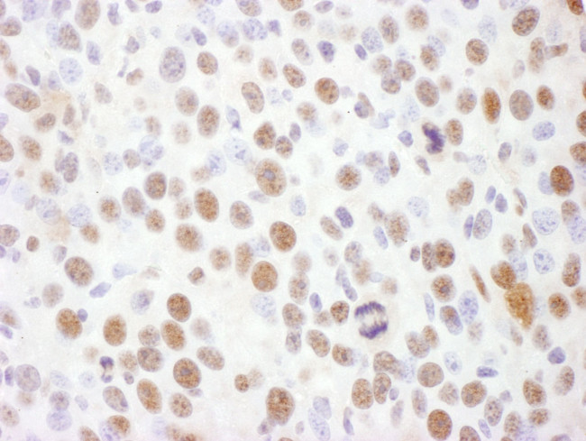 Phospho-Rad17 (Ser645) Antibody in Immunohistochemistry (IHC)