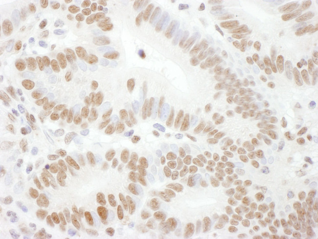 Phospho-Rad17 (Ser645) Antibody in Immunohistochemistry (IHC)