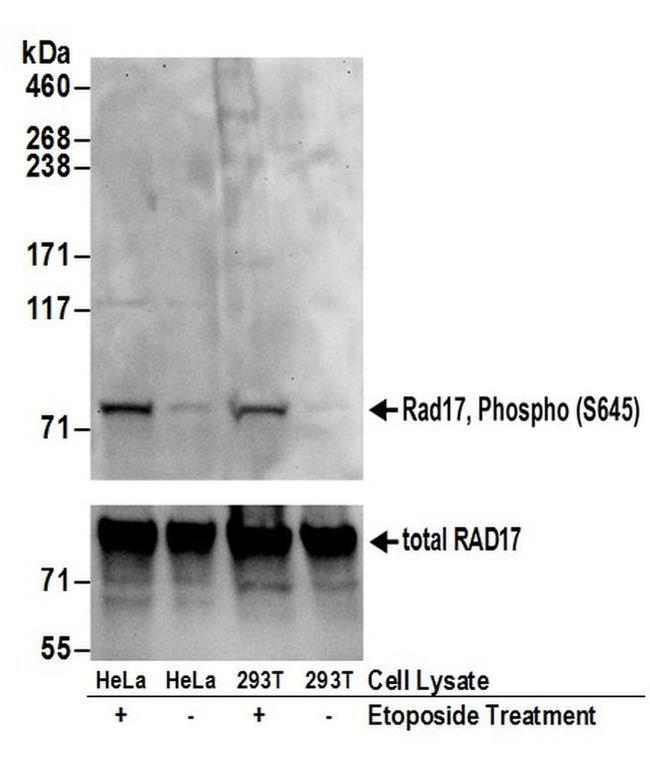 Phospho-Rad17 (Ser645) Antibody in Western Blot (WB)