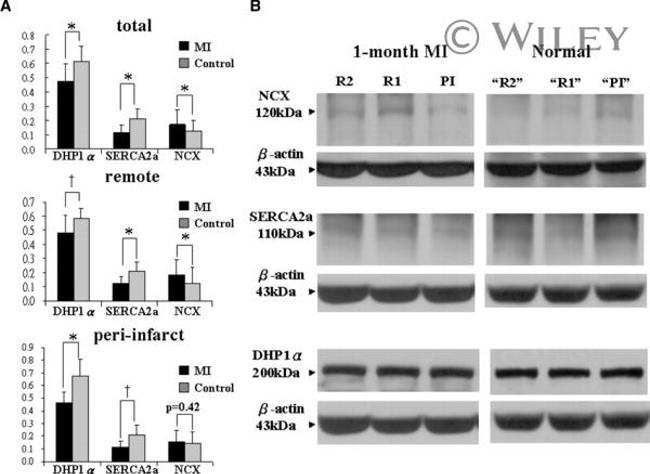 Sodium/Calcium Exchanger Antibody in Western Blot (WB)