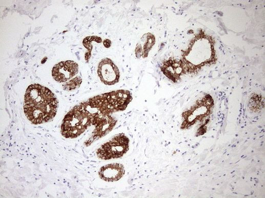 pan Cytokeratin (pan CK) Antibody in Immunohistochemistry (Paraffin) (IHC (P))