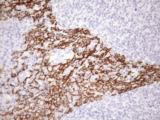 pan Cytokeratin (pan CK) Antibody in Immunohistochemistry (Paraffin) (IHC (P))