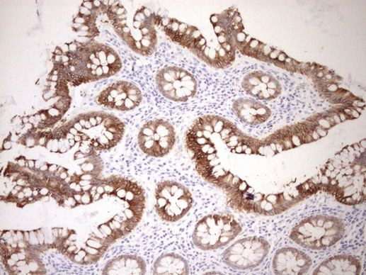 pan Cytokeratin (pan CK) Antibody in Immunohistochemistry (Paraffin) (IHC (P))