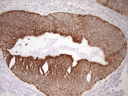 pan Cytokeratin (pan CK) Antibody in Immunohistochemistry (Paraffin) (IHC (P))