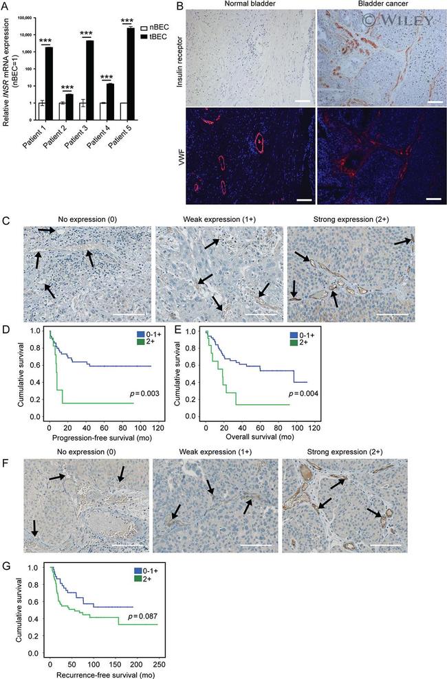 INSR beta Antibody in Immunohistochemistry (Paraffin) (IHC (P))