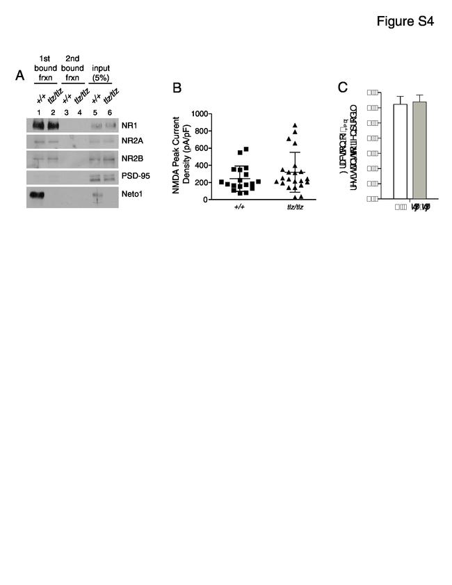 NMDAR2A Antibody in Western Blot (WB)