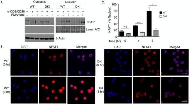 NFATC2 Antibody in Immunocytochemistry (ICC/IF)