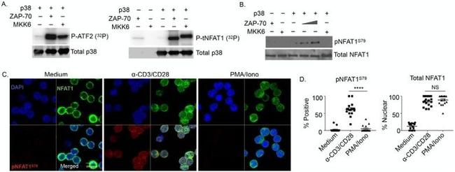 NFATC2 Antibody in Immunocytochemistry (ICC/IF)