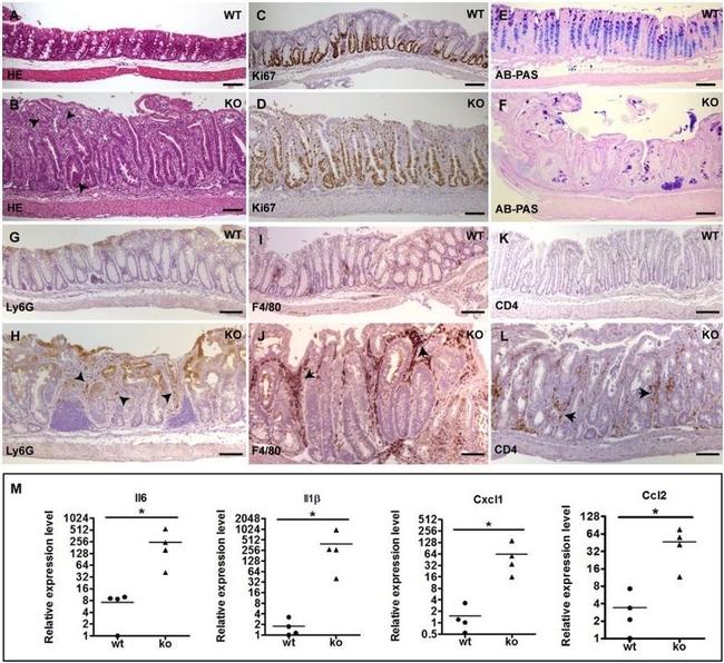 CD4 Antibody in Immunohistochemistry (IHC)