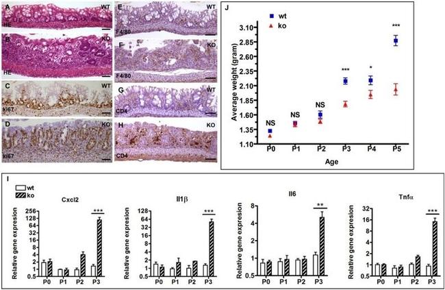 CD4 Antibody in Immunohistochemistry (IHC)