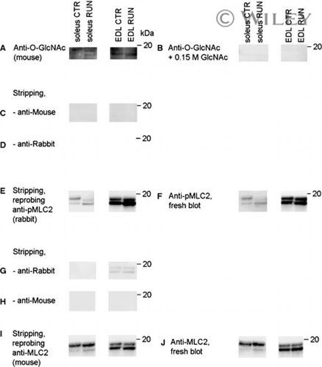 O-linked N-acetylglucosamine (O-GlcNAc) Antibody in Western Blot (WB)