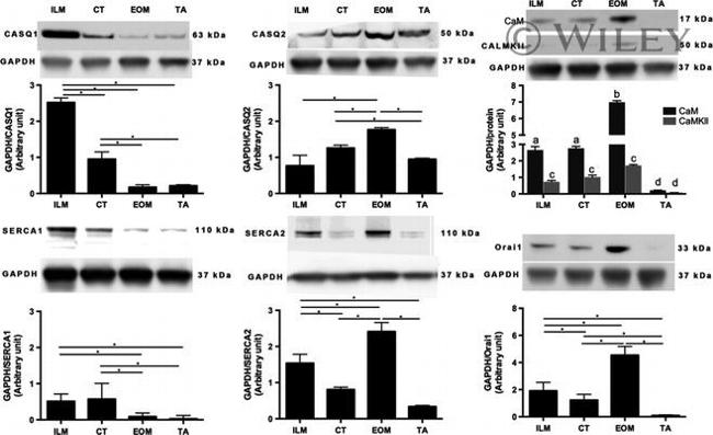 Calsequestrin Antibody in Western Blot (WB)