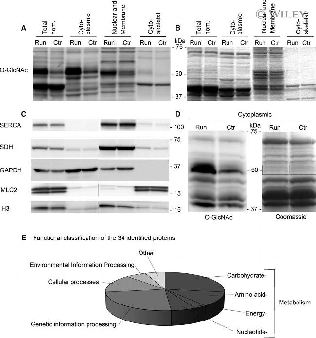 SERCA2 ATPase Antibody in Western Blot (WB)