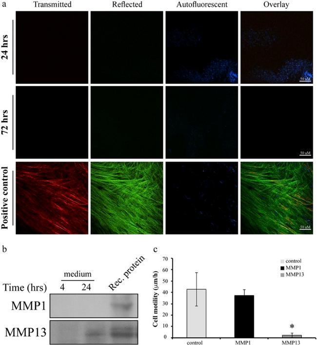 MMP1 Antibody in Western Blot (WB)