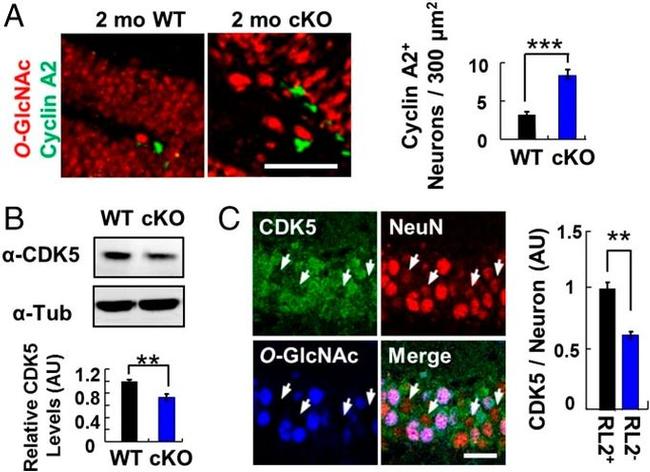 O-linked N-acetylglucosamine (O-GlcNAc) Antibody in Immunohistochemistry (IHC)