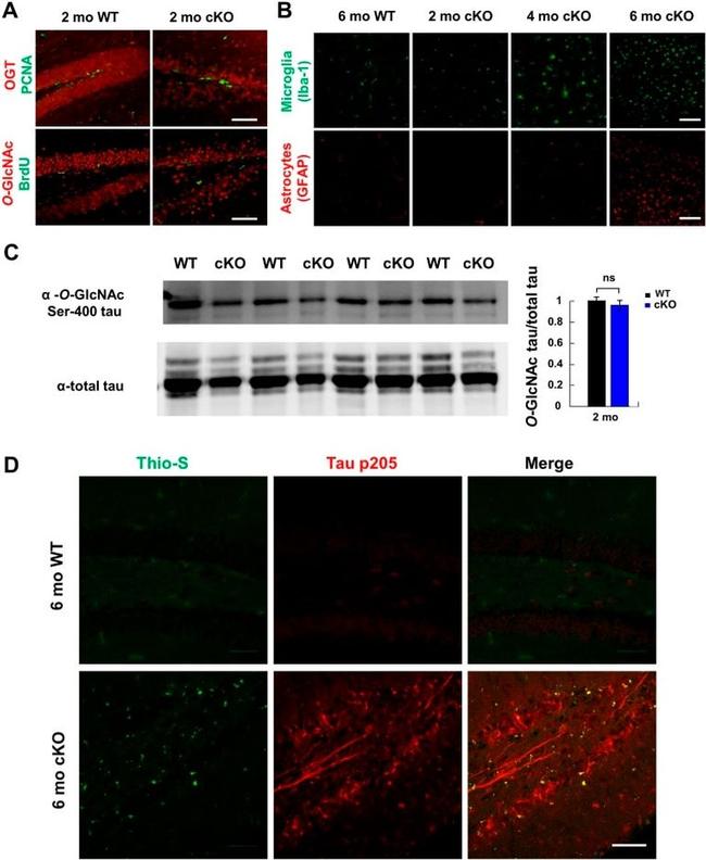 O-linked N-acetylglucosamine (O-GlcNAc) Antibody in Immunohistochemistry (IHC)