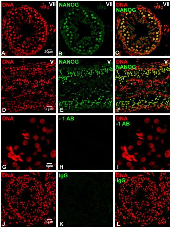 Nanog Antibody in Immunohistochemistry (IHC)