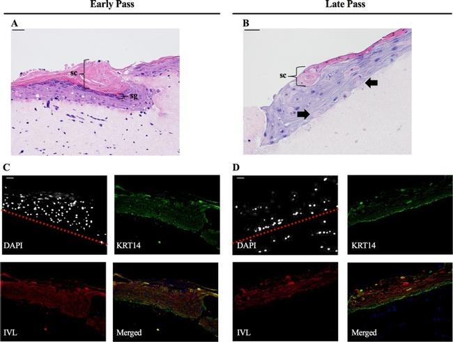 Involucrin Antibody in Immunohistochemistry (IHC)