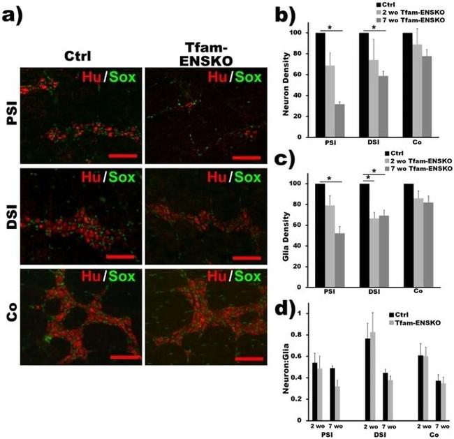 HuC/HuD Antibody in Immunohistochemistry (IHC)