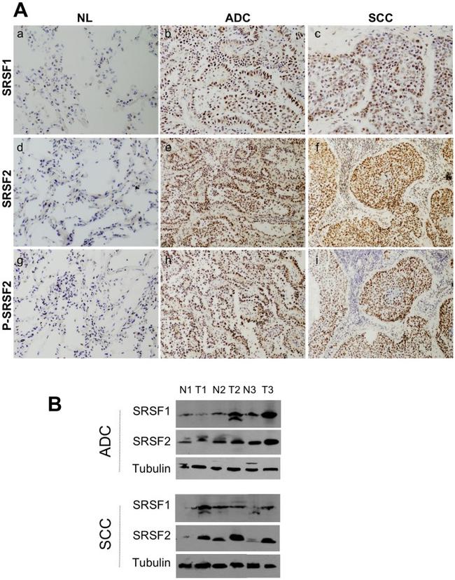 SRSF1 Antibody in Western Blot, Immunohistochemistry (Frozen) (WB, IHC (F))