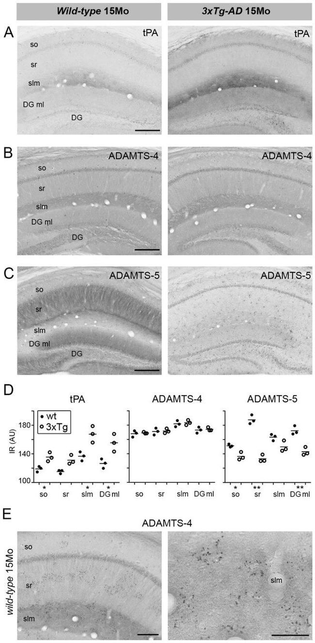 ADAMTS4 Antibody in Immunohistochemistry (IHC)