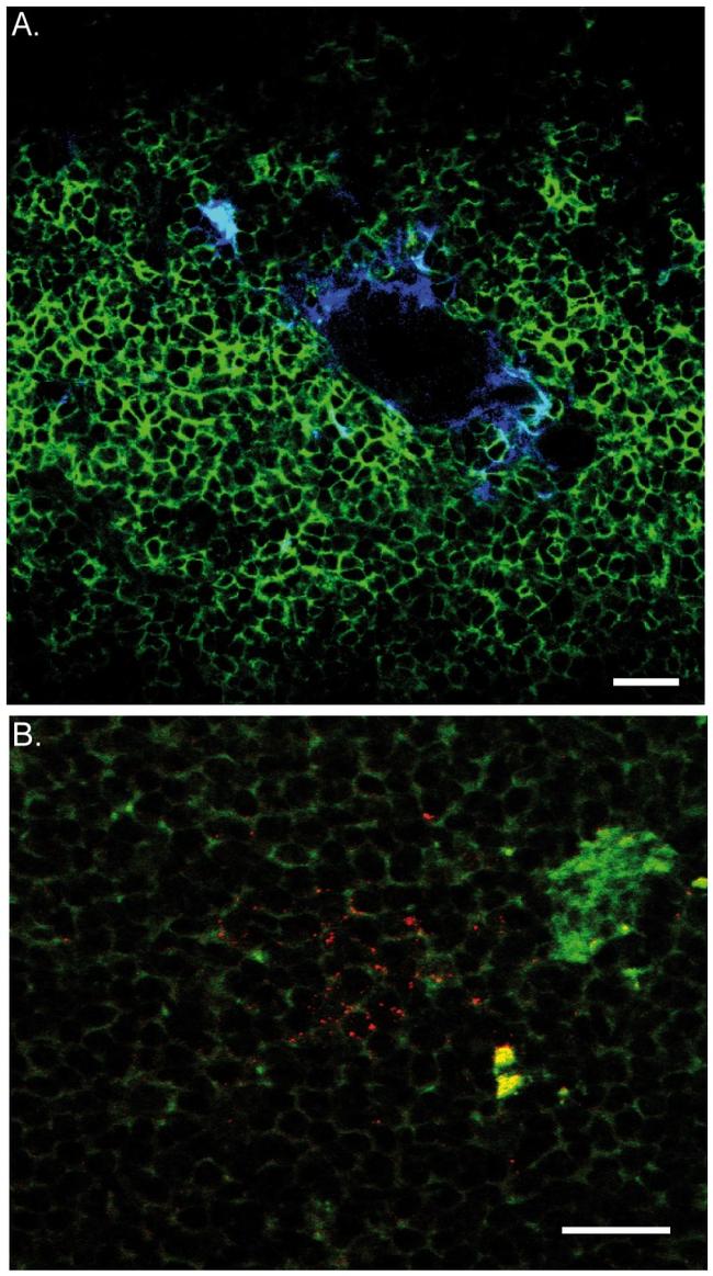 Texas Red Antibody in Immunohistochemistry (IHC)