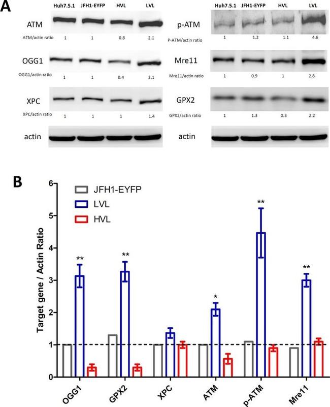 Phospho-ATM (Ser1981) Antibody in Western Blot (WB)