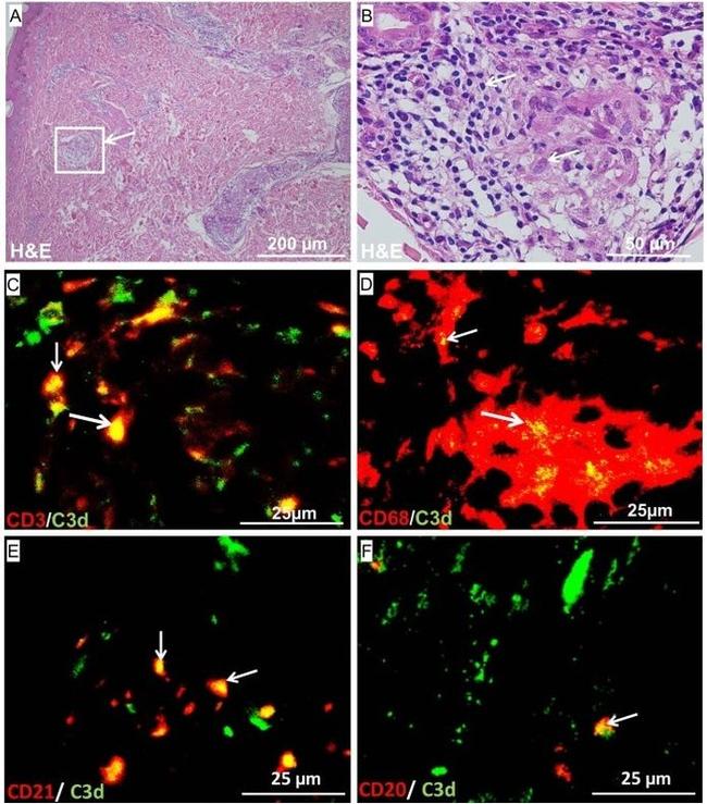 CD3 Antibody in Immunohistochemistry (IHC)