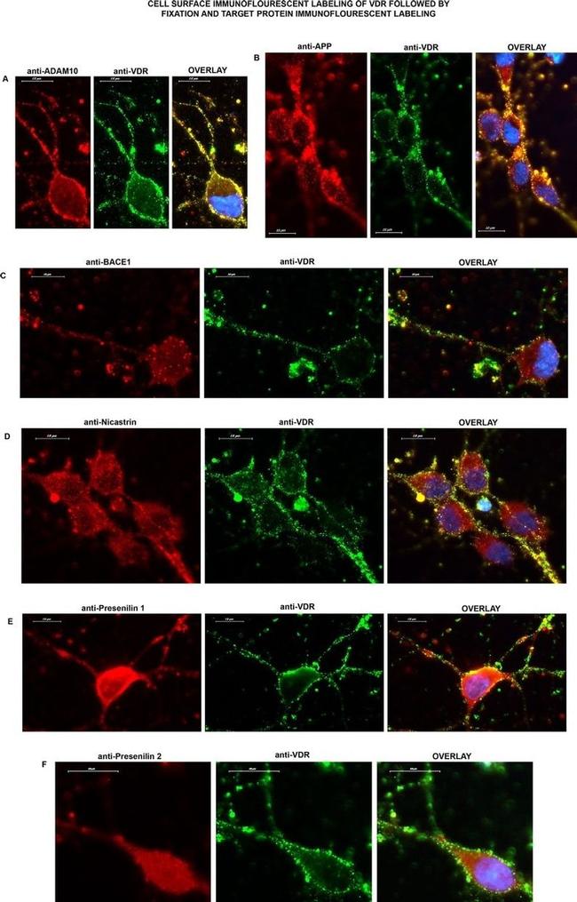 BACE1 Antibody in Immunocytochemistry (ICC/IF)