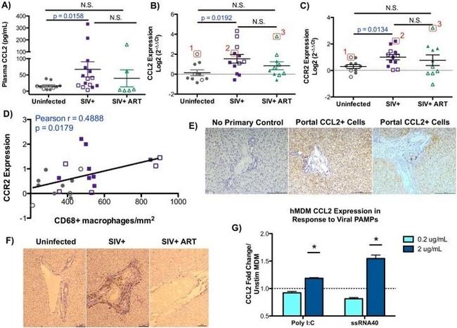 MCP-1 Antibody in Immunohistochemistry (IHC)