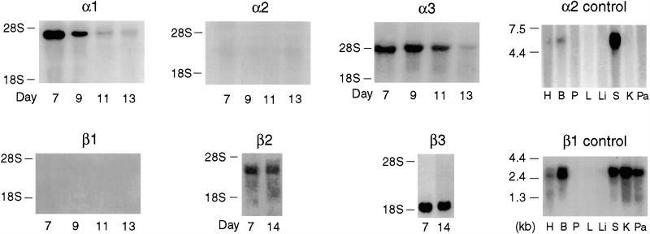 ATP1A3 Antibody in Western Blot (WB)