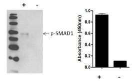 Human SMAD1 (Phospho) [pS463/pS465] InstantOne™ ELISA Kit