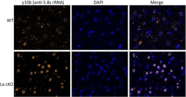 rRNA Antibody in Immunocytochemistry, Immunohistochemistry - Free Floating (ICC/IF, IHC (Free))