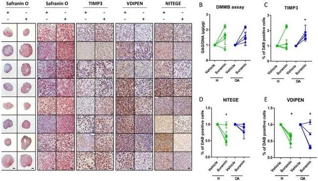 TIMP3 Antibody in Immunohistochemistry (IHC)